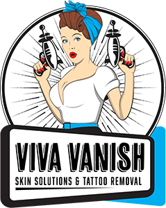 Viva Vanish Laser Tattoo Removal