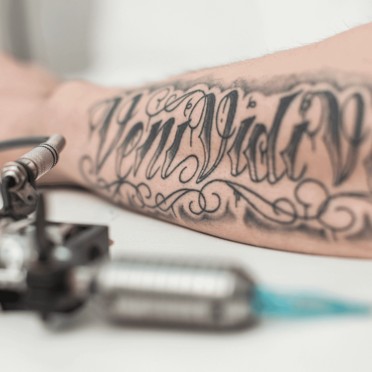 Tattoo Removal Las Vegas Cost