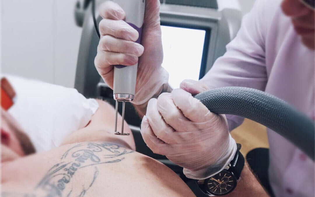 Best Tattoo Removal Clinics in Las Vegas, Nevada