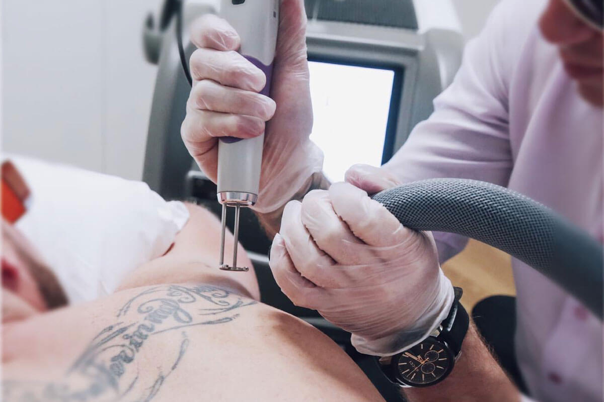 best tattoo removal clinics in las vegas, nevada