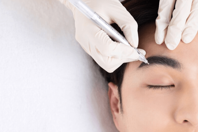 Pico Laser Eyebrow Tattoo Removal