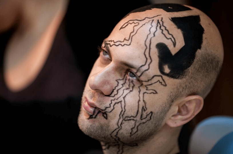 Face Tattoo Removal