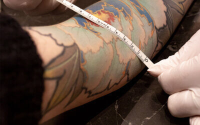 tattoo removal cost calculator