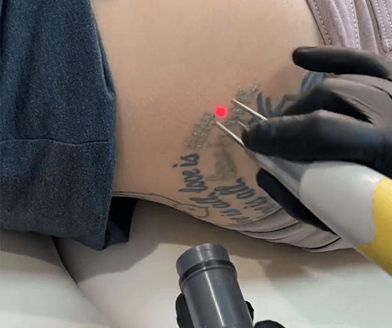 Surgery Tattoo Las Vegas