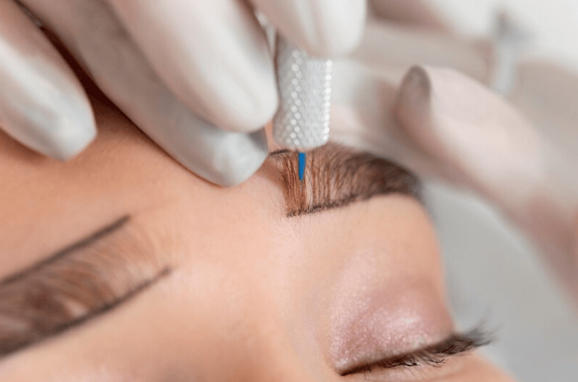 How to Remove Eyebrow Tattoo