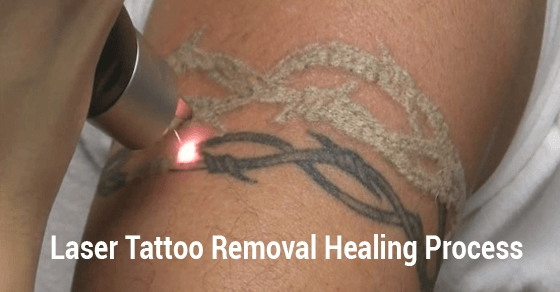 Tattoo Healing Process